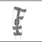 DJO DONJOY OA Fullforce Knee Brace Manual Thumb